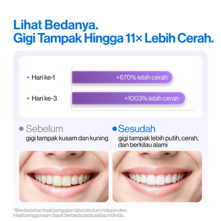 Usmile Pasta Gigi Optical White